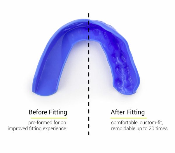 SISU Aero 3D Mouth Guard - Image 2